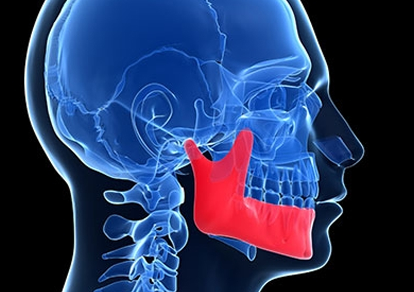 Kraniomandibular Disfonksiyon